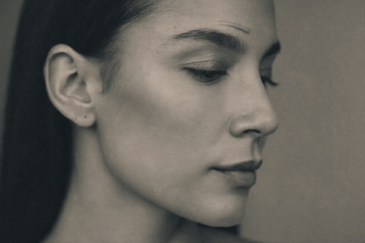 Anti-Wrinkle at SkinMedics